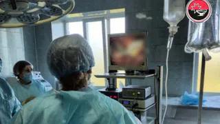 Операцию по удалению четырехкилограммовой опухоли яичника провели врачи-гинекологи из Удмуртии