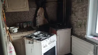 Пенсионерка едва не погибла на пожаре в Удмуртии
